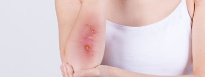 2022民法典规定一方患重病结婚怎么处理